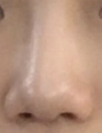 [プチ] dbwladl - 鼻