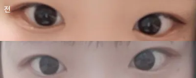 [目] シン・ウンソです - 目