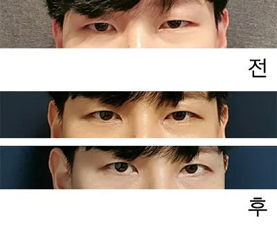 [目] WDHH - 目つき矯正