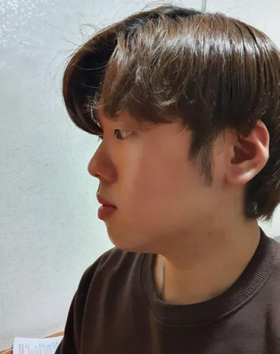 [男性] 腫れぼったさ解消 - 目、鼻