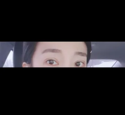 [目] ハーフバフ - 目の再手術