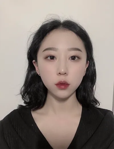 [プチ] 夜のマンゴースナ - ボトックス、フィラー