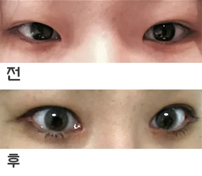 [目] jdnendndj - 目