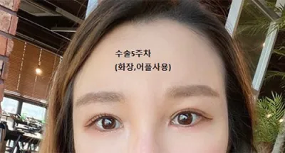 [目] なおりうり - 目