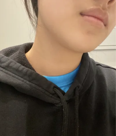 [쁘띠] ミュイムヤ - 輪郭注射、シュリンク