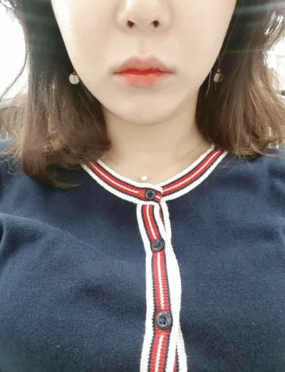 [쁘띠] チョン・ショニ - ボトックス、シャネル注射