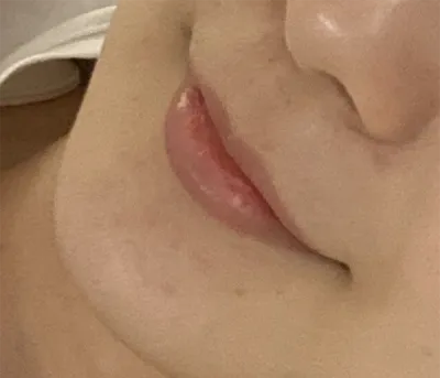 [プチ] クルムクルム2 - 唇