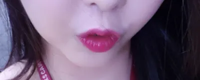 [プチ] 黄金빛레야 - フィラー、糸リフティング