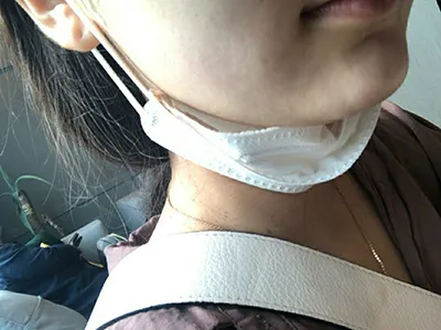 [皮膚] ウンサム - シューリンク