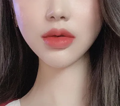 [プチ] セヨリン - 小鼻ボトックス