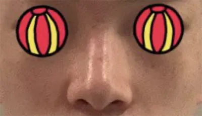 [鼻] ヒョニ9801 - 鼻