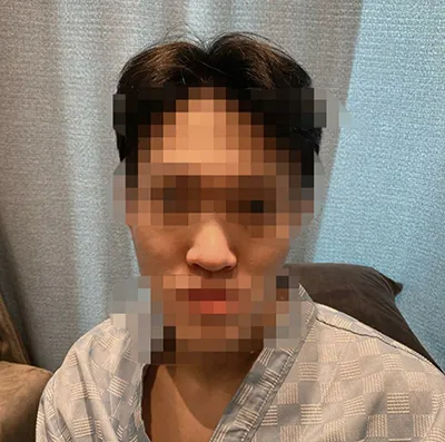 [鼻] ミミズ2@ - 鼻