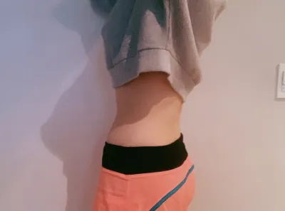 [脂肪吸引] yedu87 - 脚、腹部の脂肪吸引