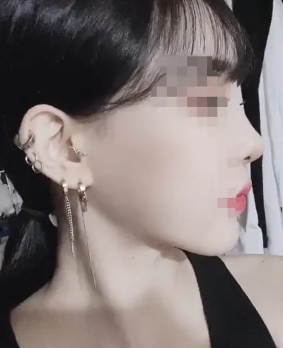 [輪郭手術] ニニ❤ - 目、輪郭