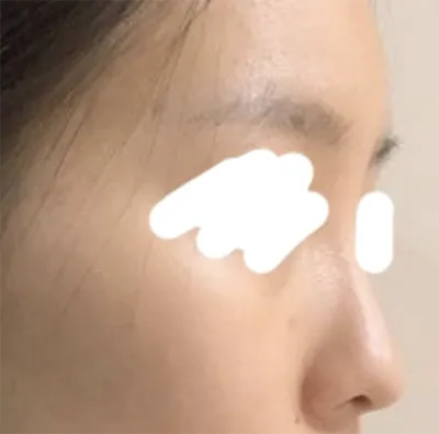 [鼻] ル삥뽕삥ㅇ - 鼻