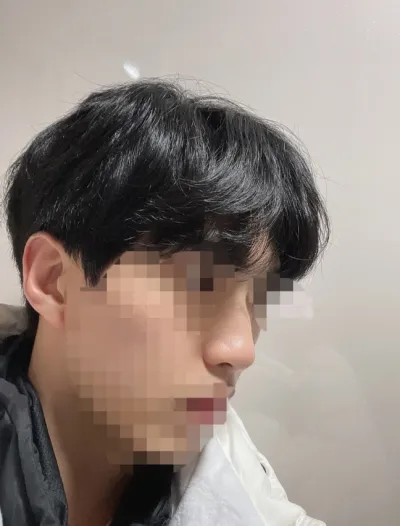 [鼻] ミンヤヤ - 鼻 (シリコン、鼻中隔軟骨)