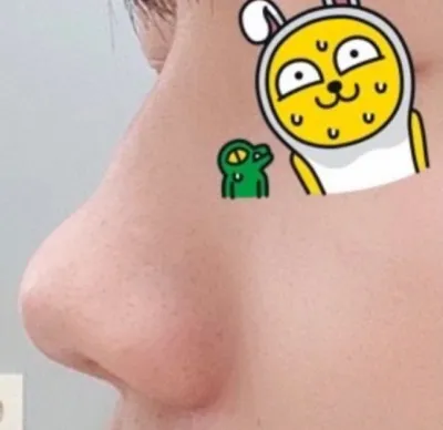 [鼻] ビションションションショル - 鼻