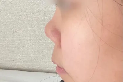 [鼻] チョン・ジヒョン2 - 鼻筋