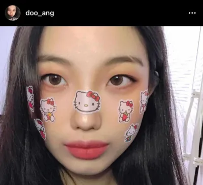 [目] ソムハナ - 二重まぶた、目頭切開