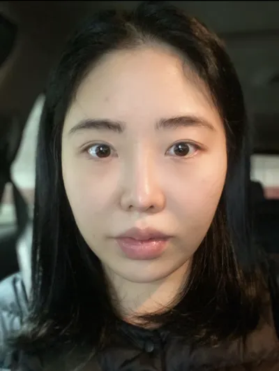 [輪郭手術] マーシャルスピーカー - 輪郭3点