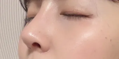 [鼻] ココリンココットゥ - 鼻