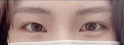 [目] itxufx - 目頭切開、目尻切開