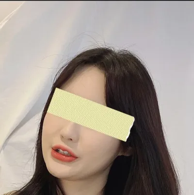 [輪郭手術] 四角い夢ㅎ - エラ削り