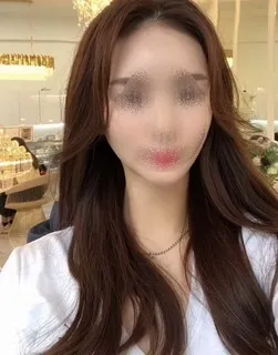 [輪郭手術] JOY - 輪郭