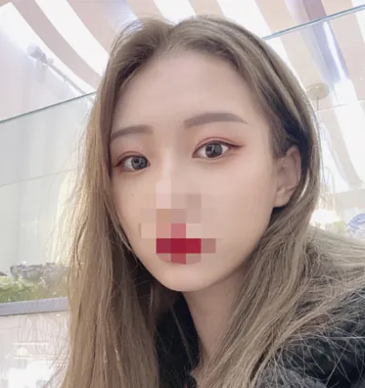 [目] クスル - 目