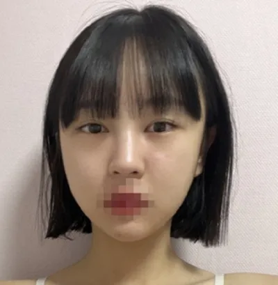 [目] ドングリ - 目