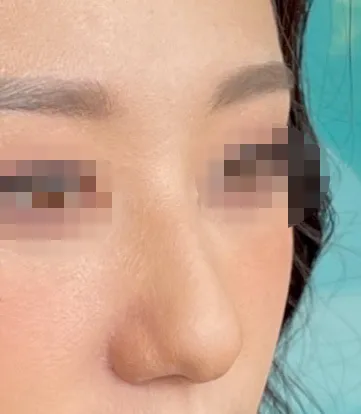 [鼻] ブラックパンサー - 鼻