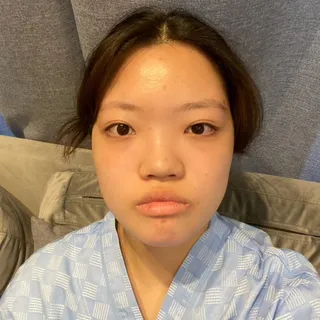 [鼻] エルサ - 目、鼻