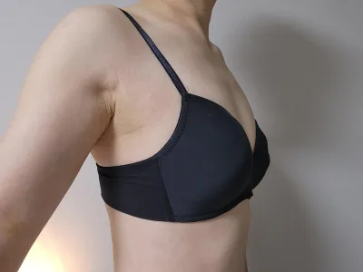 [豊胸] モノグラム - 胸