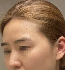 [鼻] オクタクパンコヤンイ - 鼻