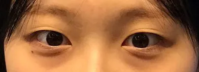 [目] コカコーラ - 目