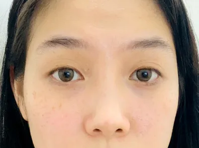 [目] ベットガール - 目、鼻