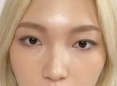 [鼻] スルビ - 鼻