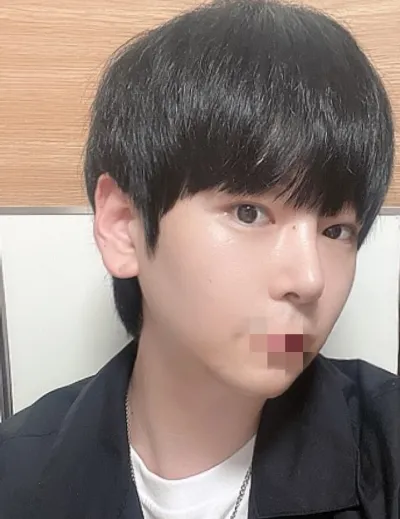 [鼻] ターゲット - 鼻