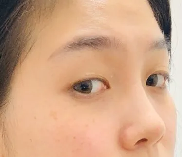 [目]クァク・ミニョ - 目、鼻