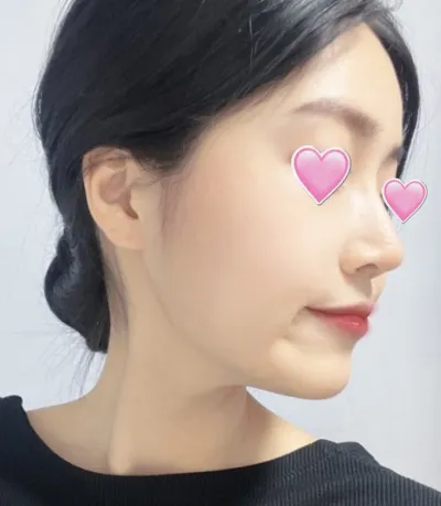 [鼻] ベイビーフォックス - 鼻