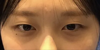 [目] オルレリ - 目