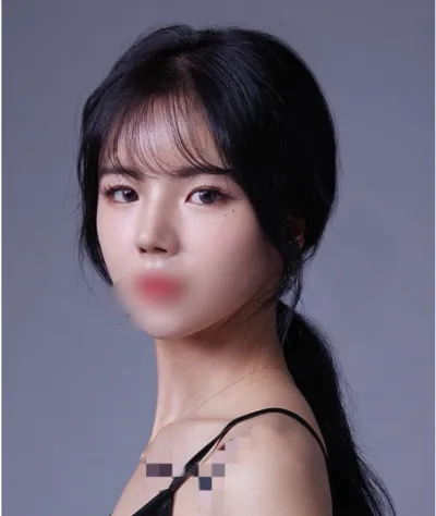 [鼻] だんご鼻 - 鼻