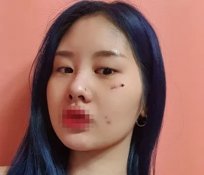 [目] 最高の先生 - 目、顔の脂肪吸引