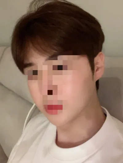 [輪郭手術] ポストイット - 輪郭