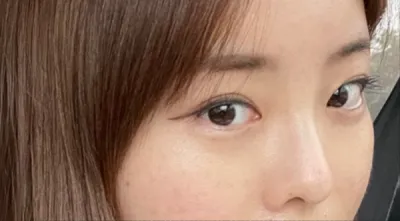 [鼻] ミユミュ - 鼻