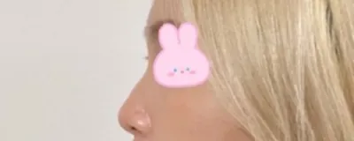 [鼻] バンクーバー - 鼻