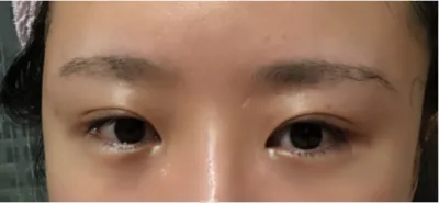 [目] マフィア - 目