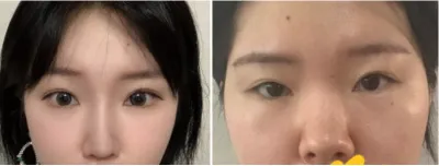 [目] だんご鼻 - 目、鼻