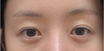 [目] 三万里 - 目