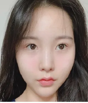 [鼻] 鼻の再手術